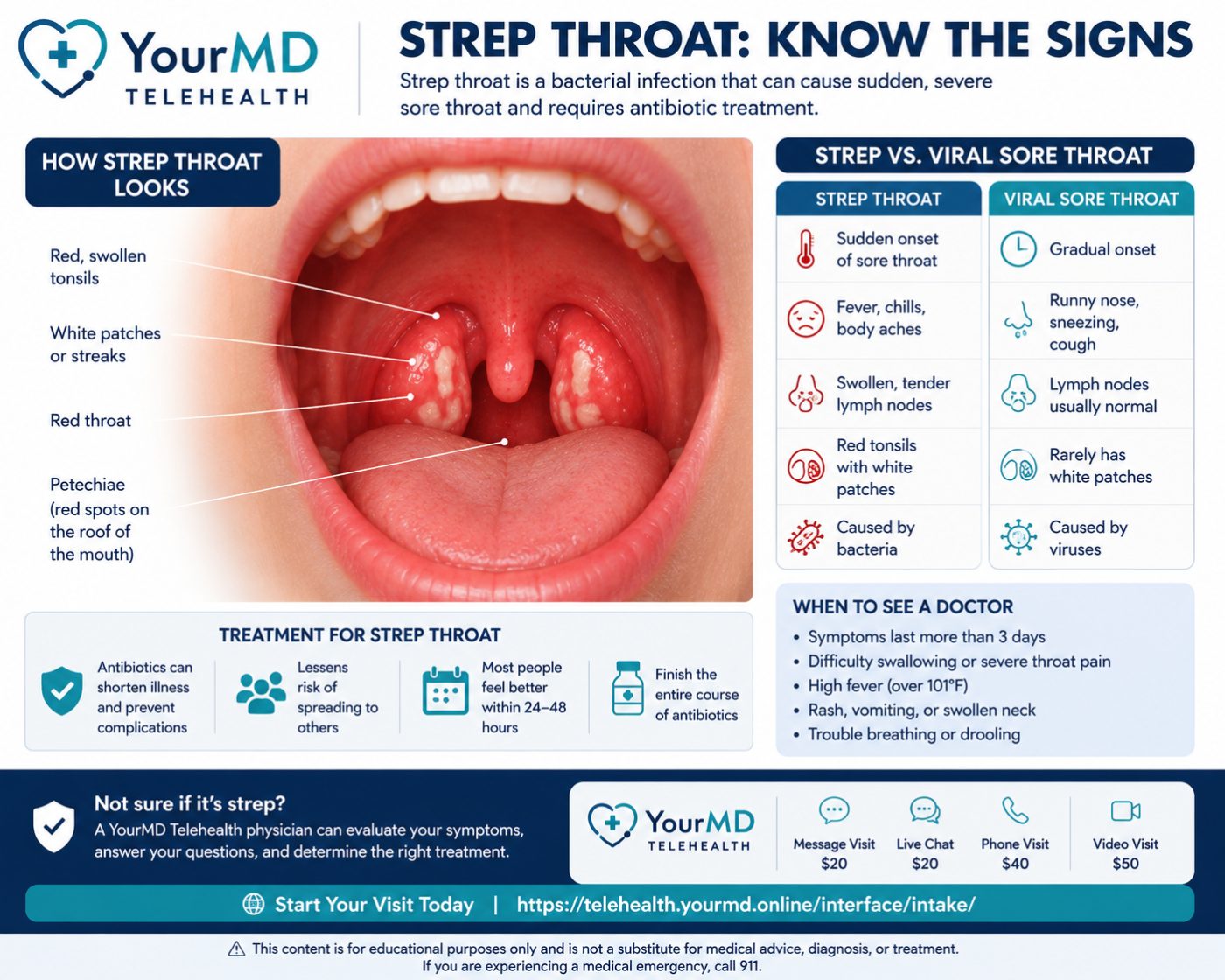 Sore Throat: Is It Strep or Just a Virus?