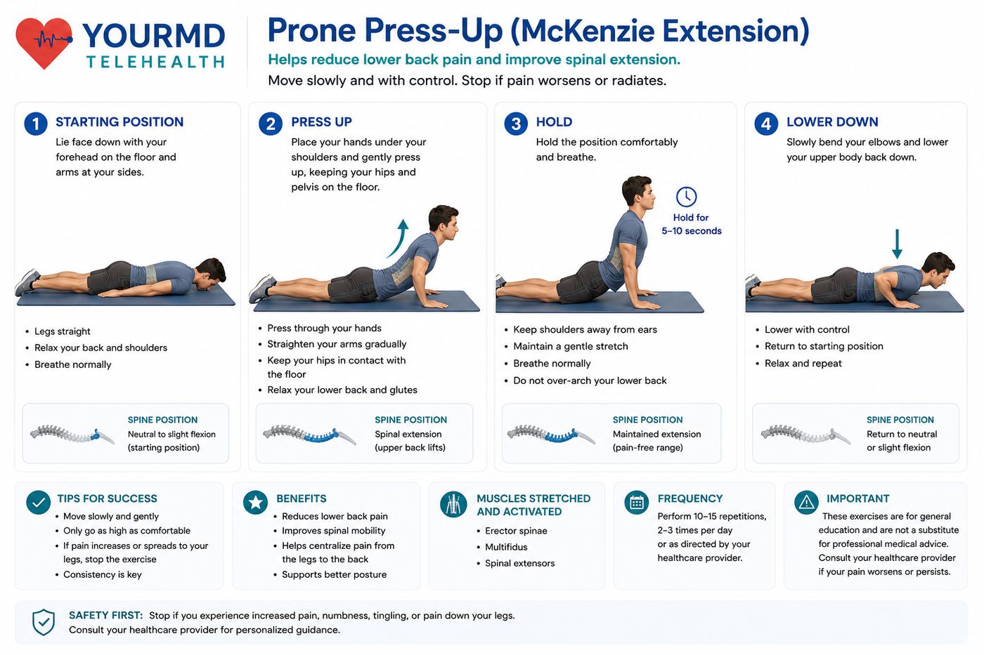Prone Press-Up (McKenzie Extension) — YourMD Telehealth patient guide